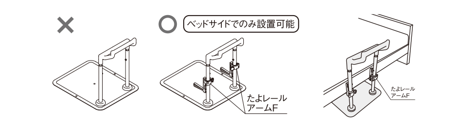 ベッドサイドでのみ設置可能