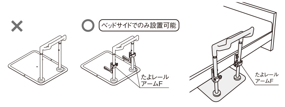 ベッドサイドでのみ設置可能